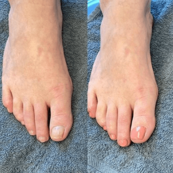 Fodbehandling hos Pretty Feet