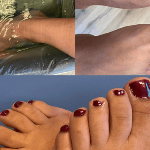 Spabehandling, fodbehandling og pedicure i Fredericia