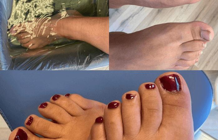 Spabehandling, fodbehandling og pedicure i Fredericia